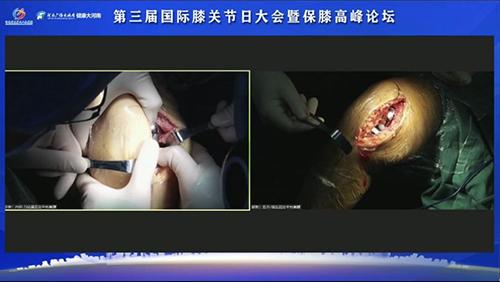 河南省郑州第三人民医院膝关节科,河南省直三医院骨科专家