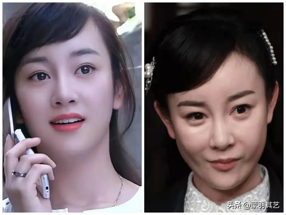 希望有一天，能禁止“整容脸”出镜，满屏硅胶玻尿酸，实在看吐了