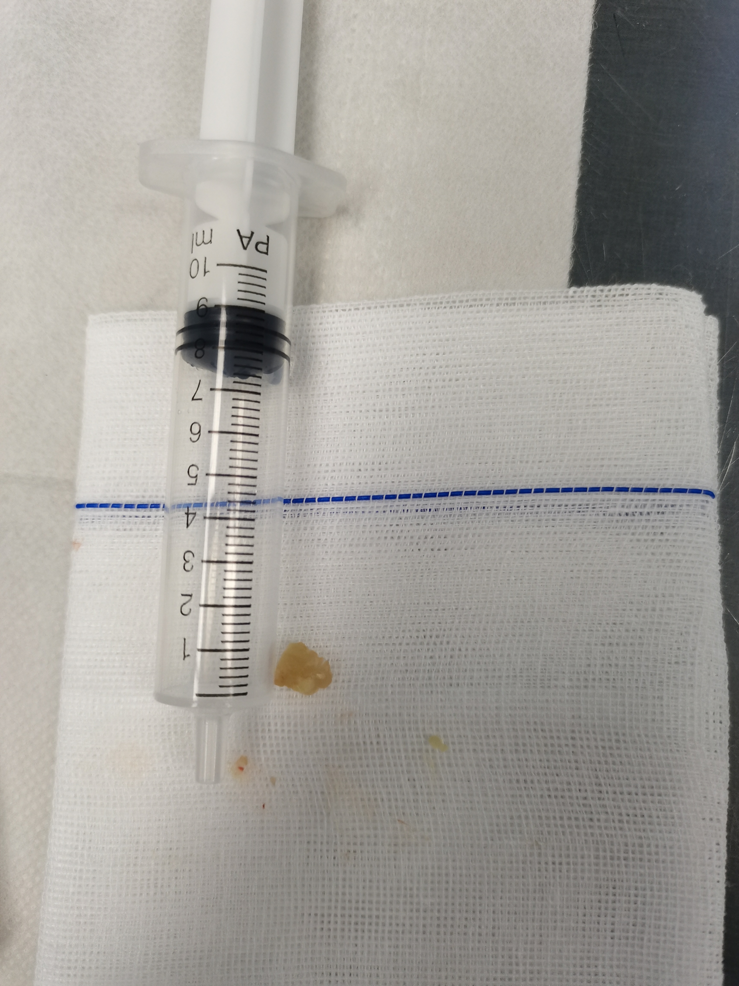 一颗花生米差点要了孩子的命,一颗花生引发的悲剧