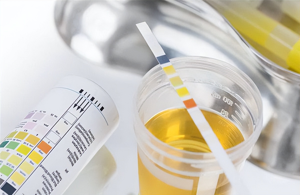 膜性肾病服药一年半后尿蛋白转阴,中医能治疗膜性肾病吗