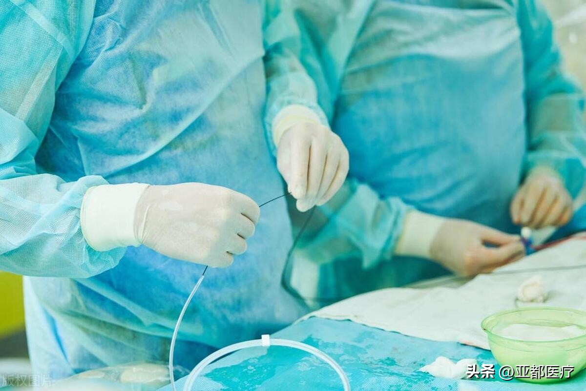 一次性使用连接管型号,临床常见的导管及固定方法