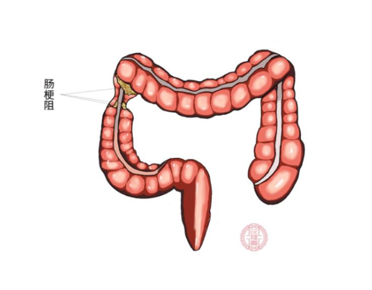 男医生做肠镜检查吗,男医生做肠镜会难为情不