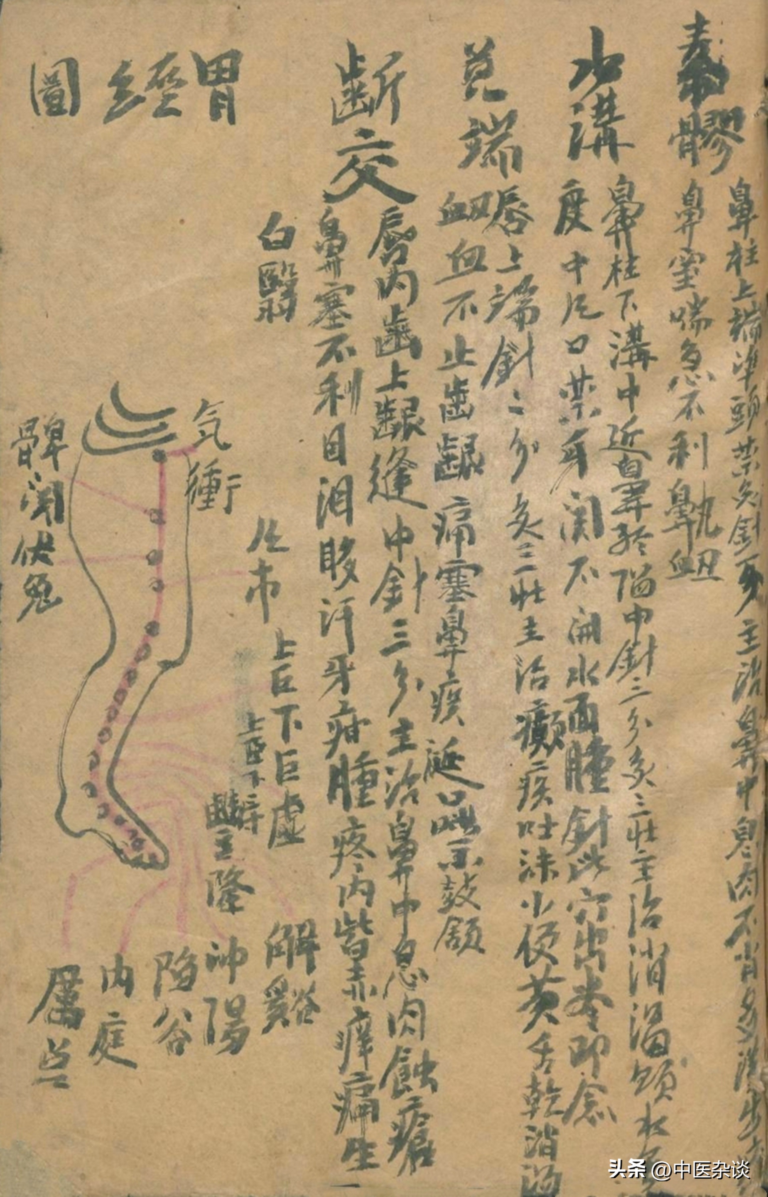 中医针刺放血疗法书,中医放痧口诀大全