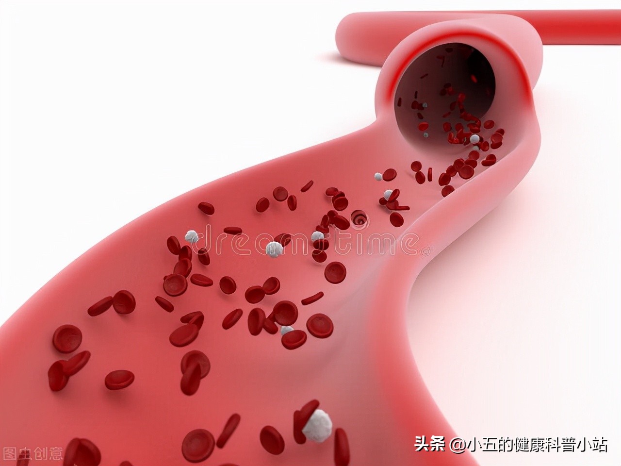 老年人暂时性脑供血不足怎么办,老人怎样改善大脑供血不足