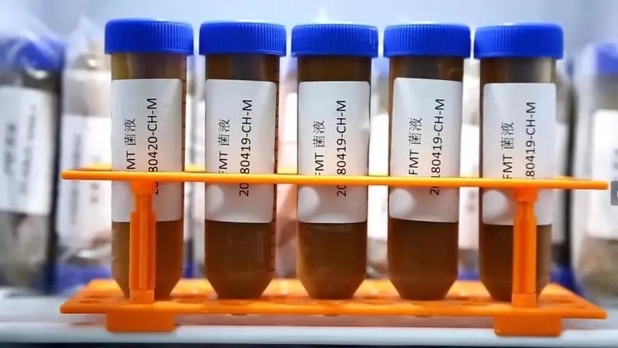 女子四处求医治便秘,结果走一大圈弯路,专家:我有一个更好方案