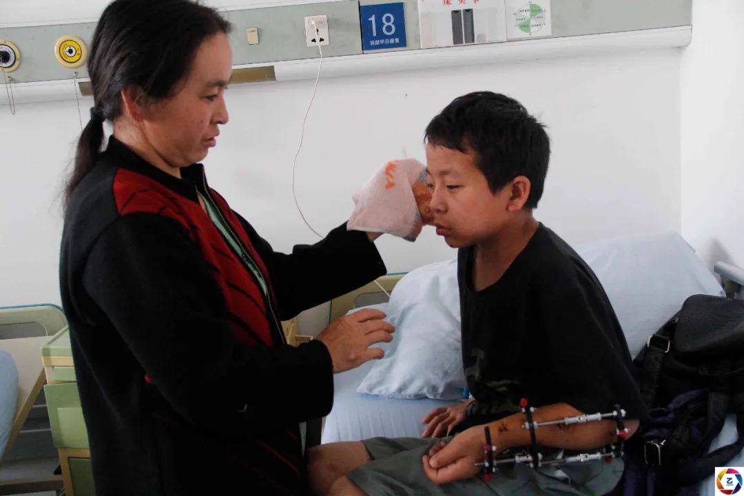 男子被石头砸伤怎么办,小男孩被石头砸到后续