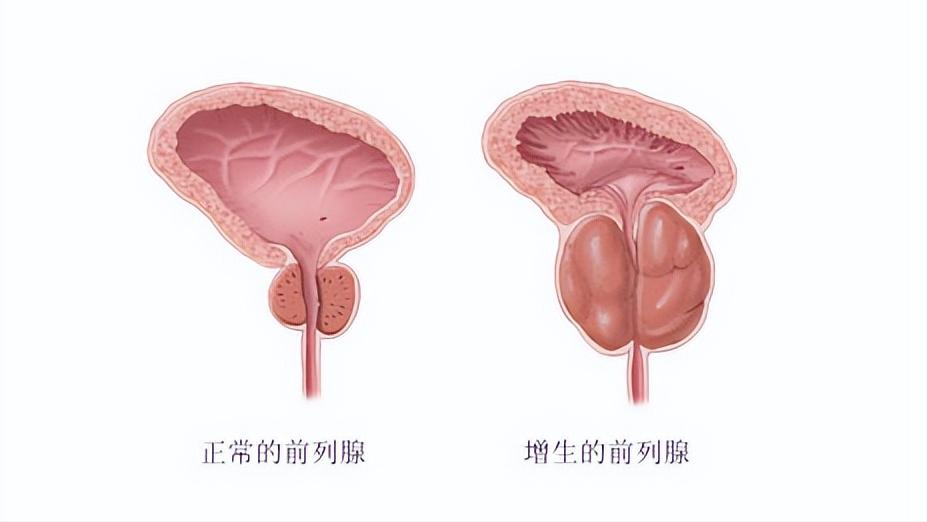 这4种病无需过度治疗,这几种病千万别过度治疗