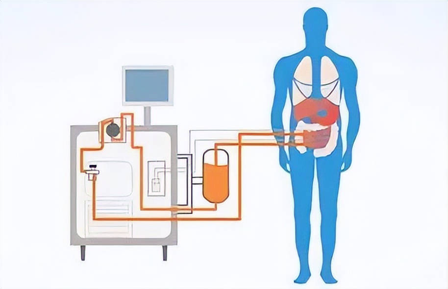 治疗腹膜癌的靶向药有哪些,腹膜癌特效药