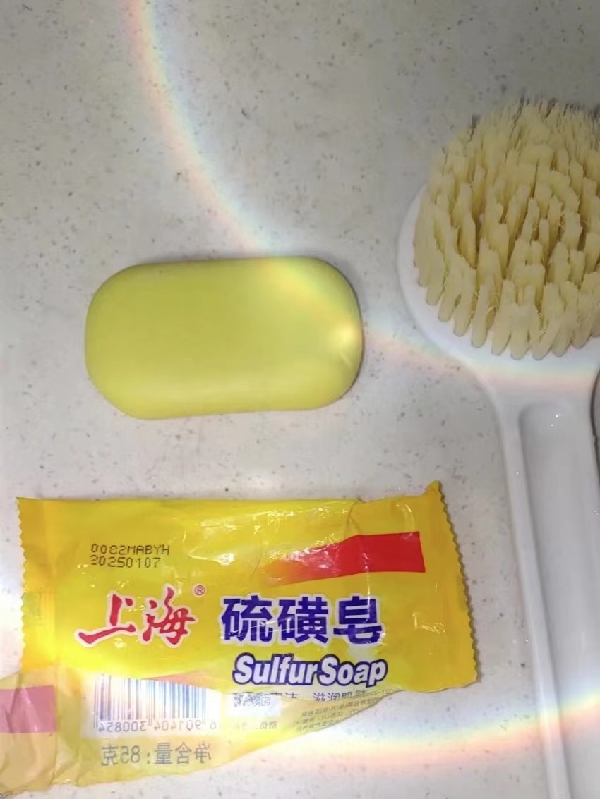 秘方去除顽固痘痘粉刺,背上痘痘痘印闭口快速祛除的妙招