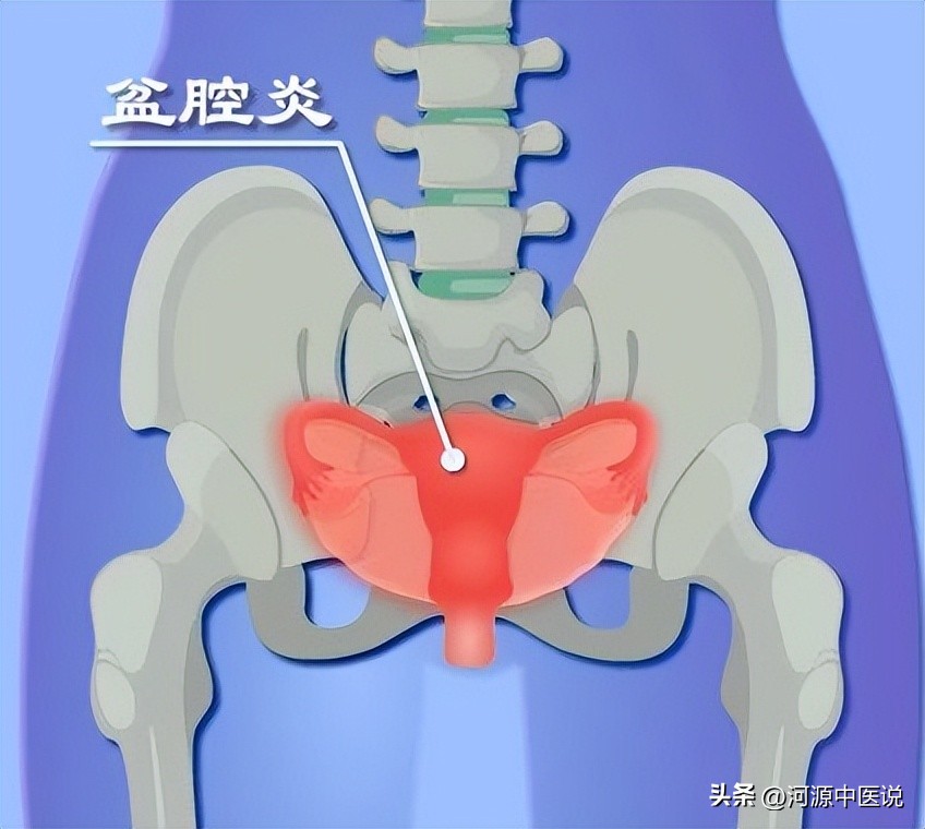 白带异常多是感染了hpv吗,白带异常多是宫颈癌吗