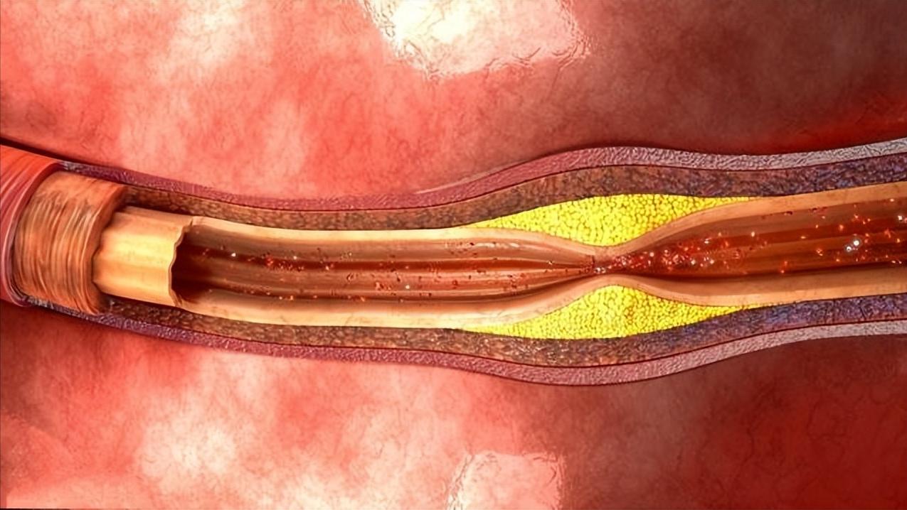 睡觉时身体突然抖一下原因是什么,睡觉中身体突然抖一下是什么原因