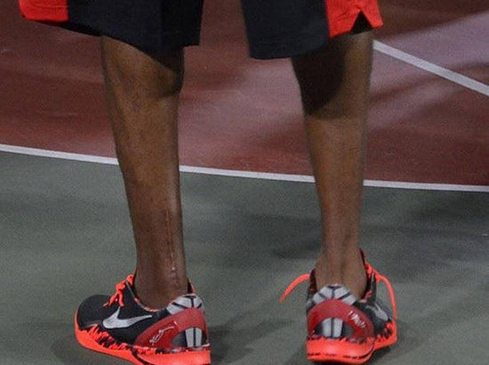 看到这些照片，就不羡慕NBA球星的高薪了！詹姆斯脚趾科比脚后跟