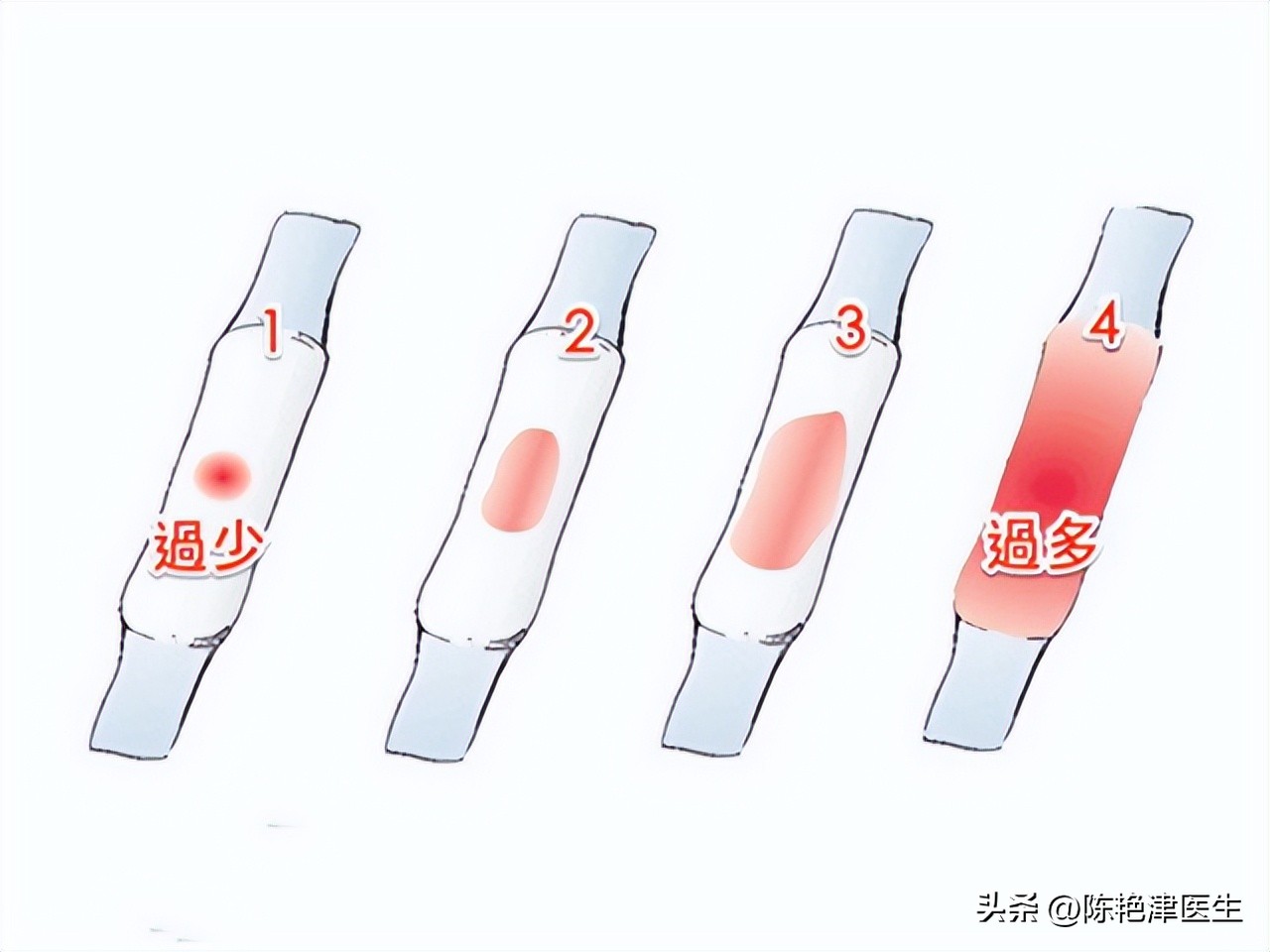 女性为什么容易长子宫肌瘤？提醒：平时尽量避免3个行为，别忽视