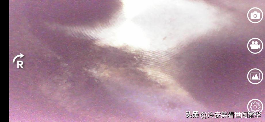 ea888免拆治理烧机油费用,ea888免拆除积碳处理多少钱