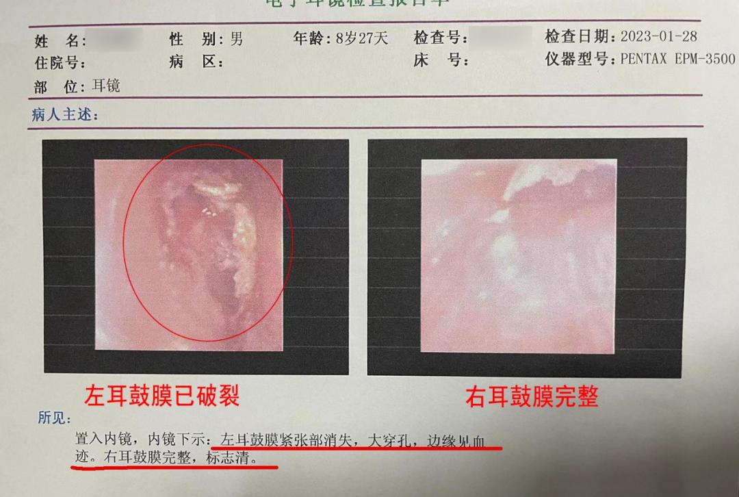 春节燃放烟花爆竹安全提示,耳朵被爆竹炸伤能恢复吗