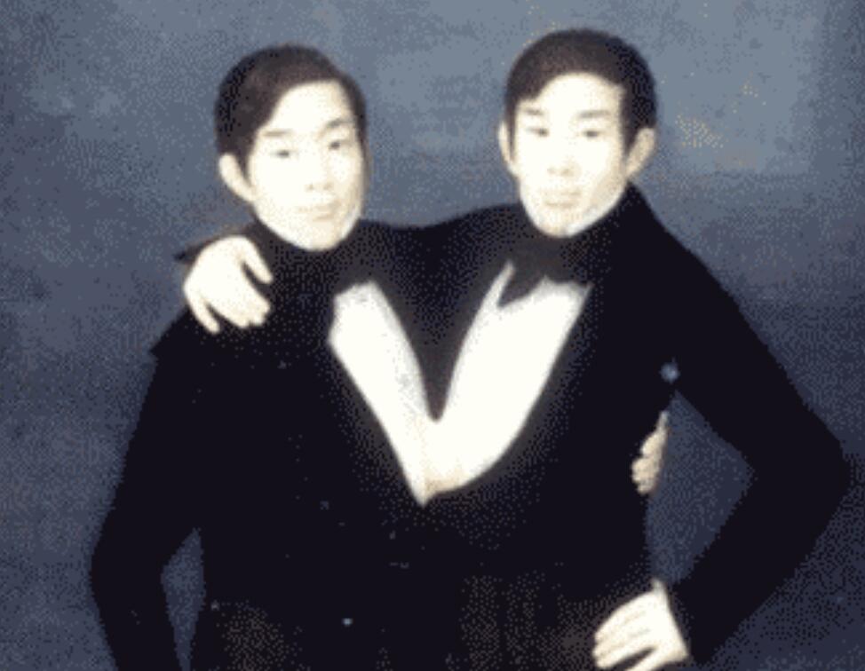 连体人该怎么结婚生子,邦克兄弟连体人