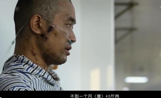 第一批新冠幸存者的故事,新冠第一批幸存者后遗症