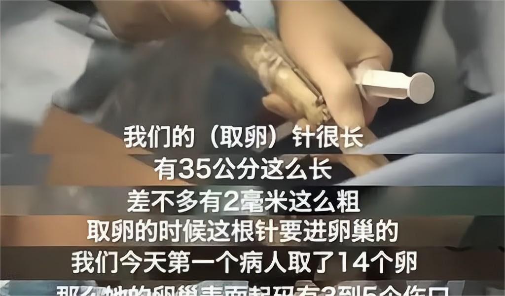 被小臂长的针刺穿阴道、卵巢，只为一部苹果手机，爱心捐卵何时休