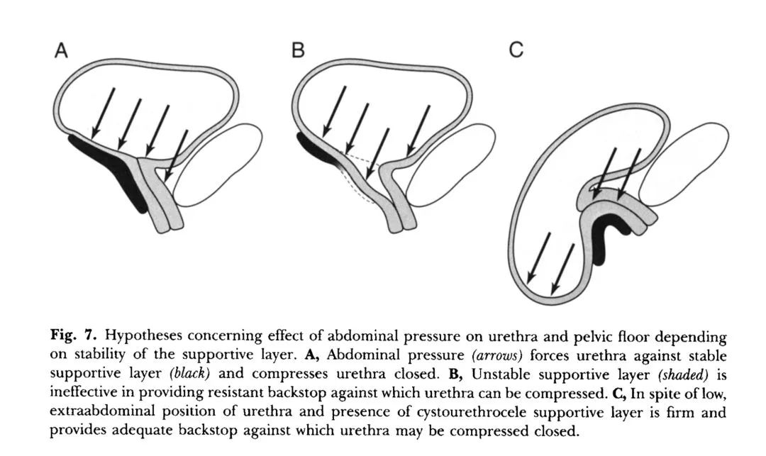 大笑就漏尿做盆底康复治疗能好吗,产后漏尿需要做几次盆底康复