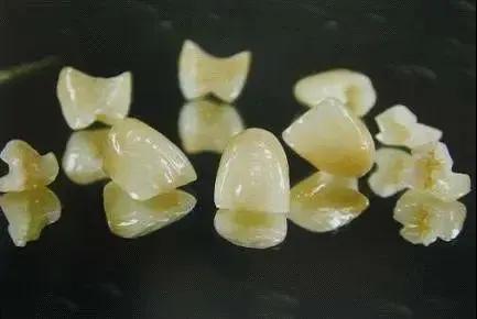 一分钟带你了解各种假牙,假牙基础知识