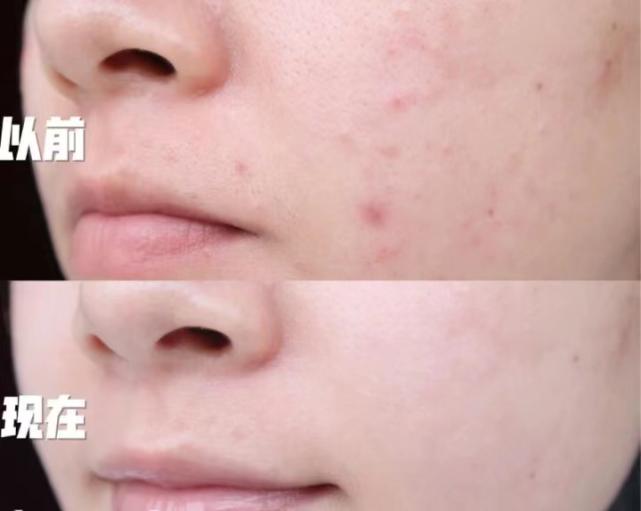 黄皮女生的护肤品,黄皮女生适合用什么护肤品