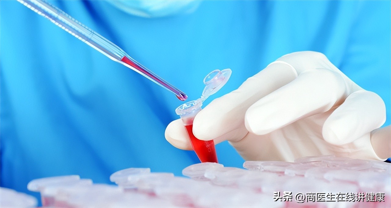 血糖高的糖化血红蛋白控制在多少,血糖控制多少达标