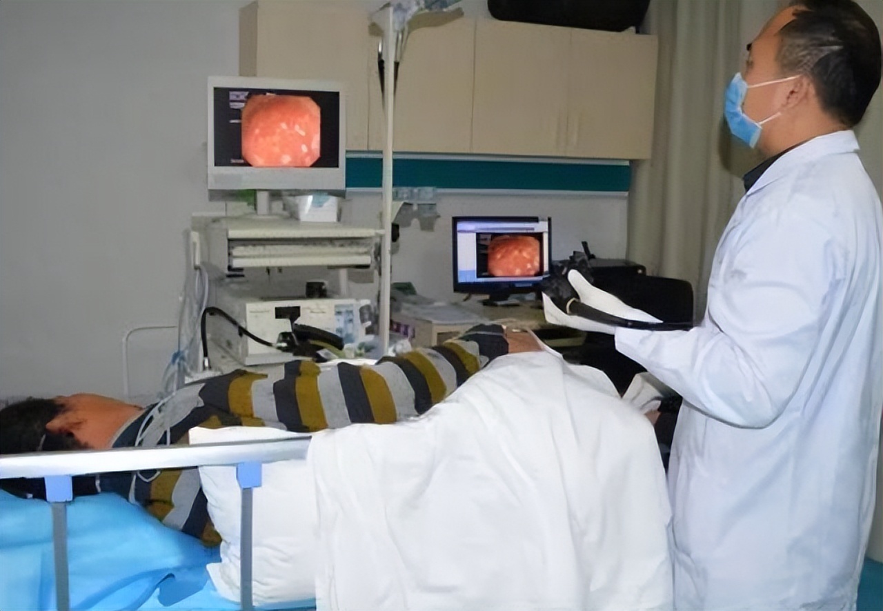 一次正常的肠镜可以确保多久,肠镜一次到底可以管多久