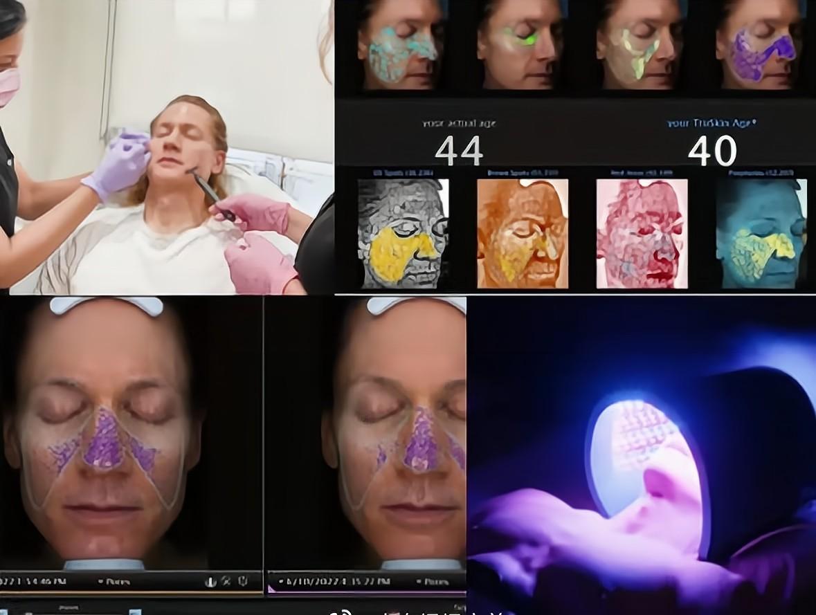 美国45岁富豪保持年轻,美国富豪复活变年轻