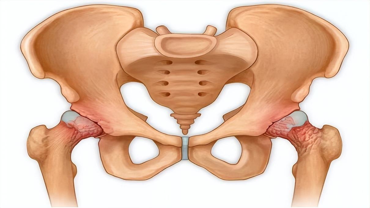 胯骨疼痛要警惕什么病,身体有病情况说明