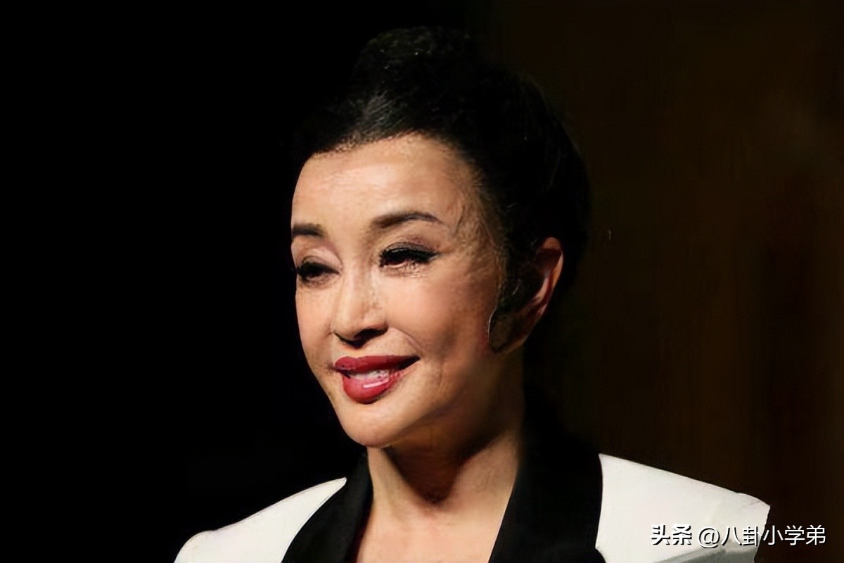 整形脸和真正的美人区别,整形变美的对比图片