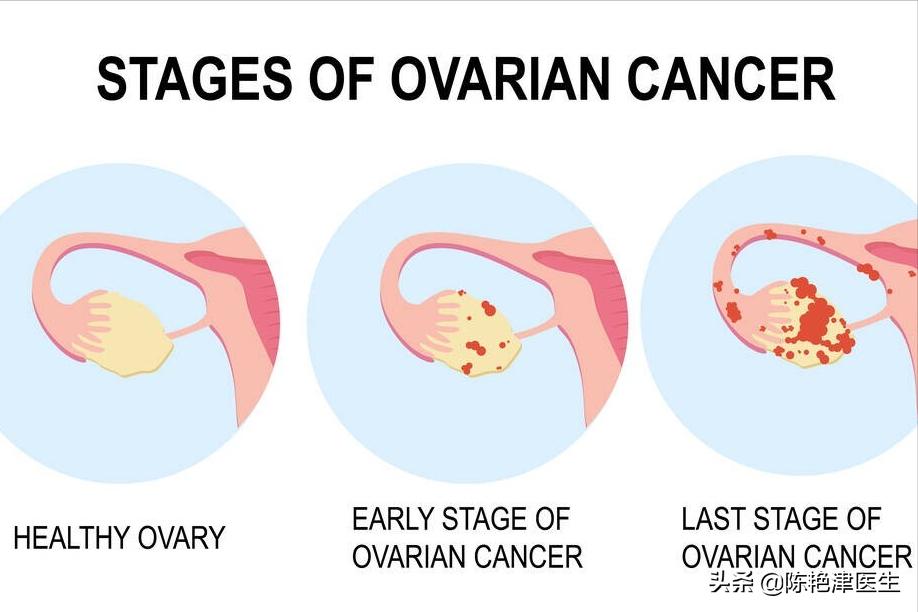 年轻妈妈妊娠纹严重的肚子照片,13岁女孩肚子爬满妊娠纹吓到妈妈