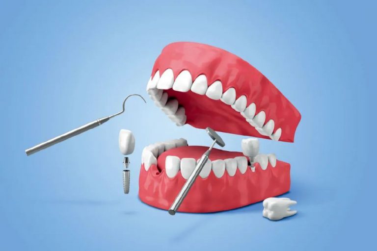 香港的牙科护理福利 (香港牙科收费价目表)