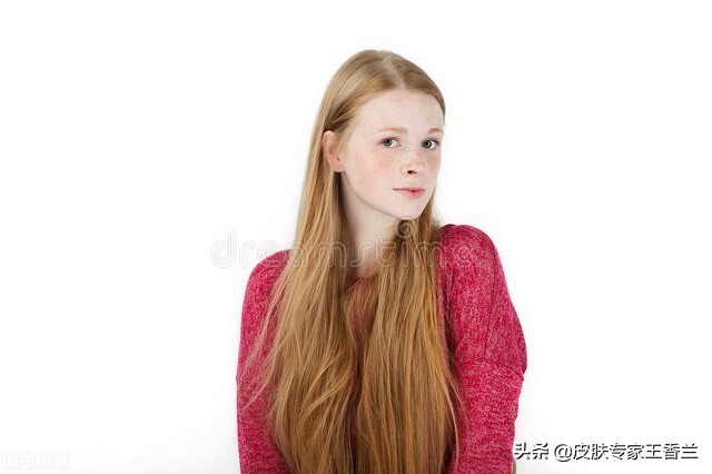 女人脸上常见的几种斑,女性朋友脸上有斑用什么护肤品