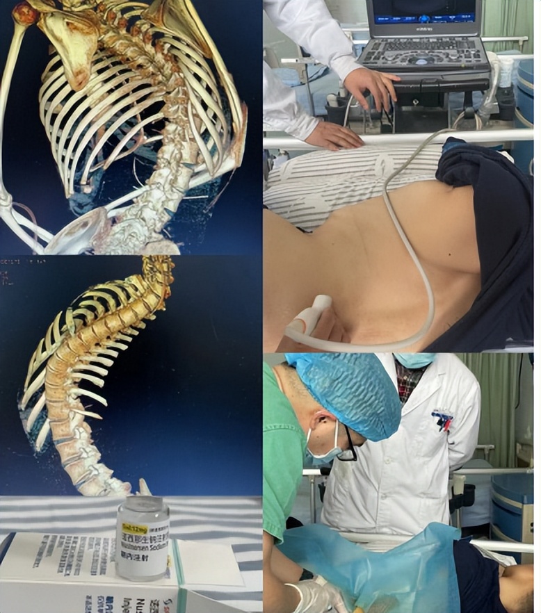 襄阳第一针接种截止日期,襄阳狂犬疫苗多少钱一针