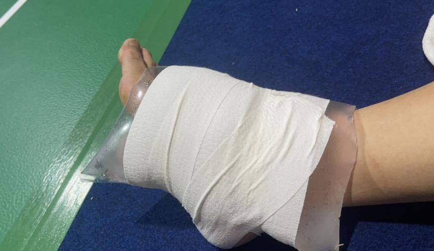 陈雨菲赛后谈伤势,陈雨菲比赛中脚崴到了很痛的视频