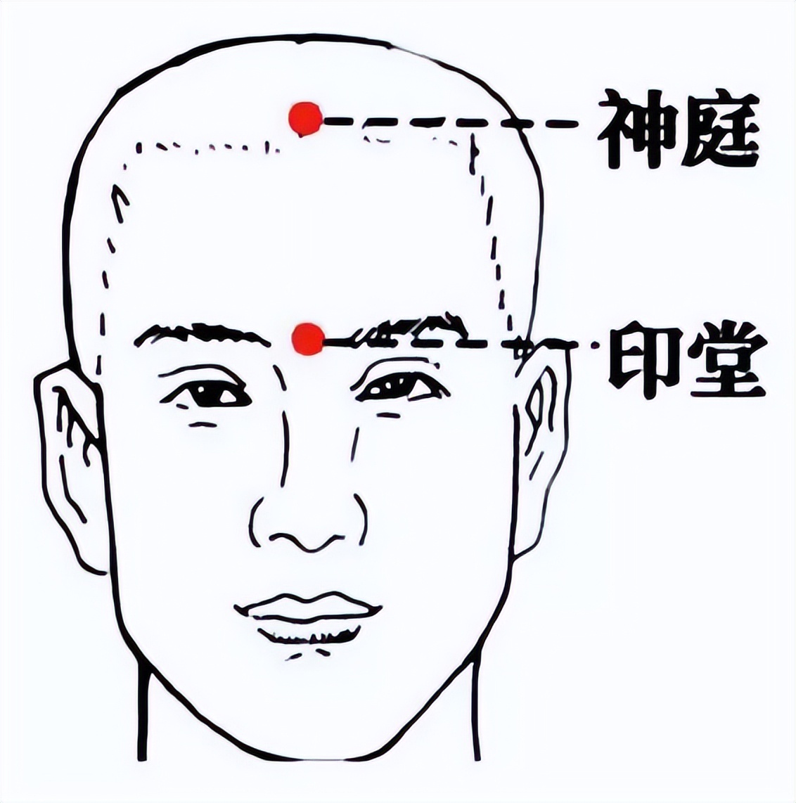 消肿的针水有哪些,消肿三针