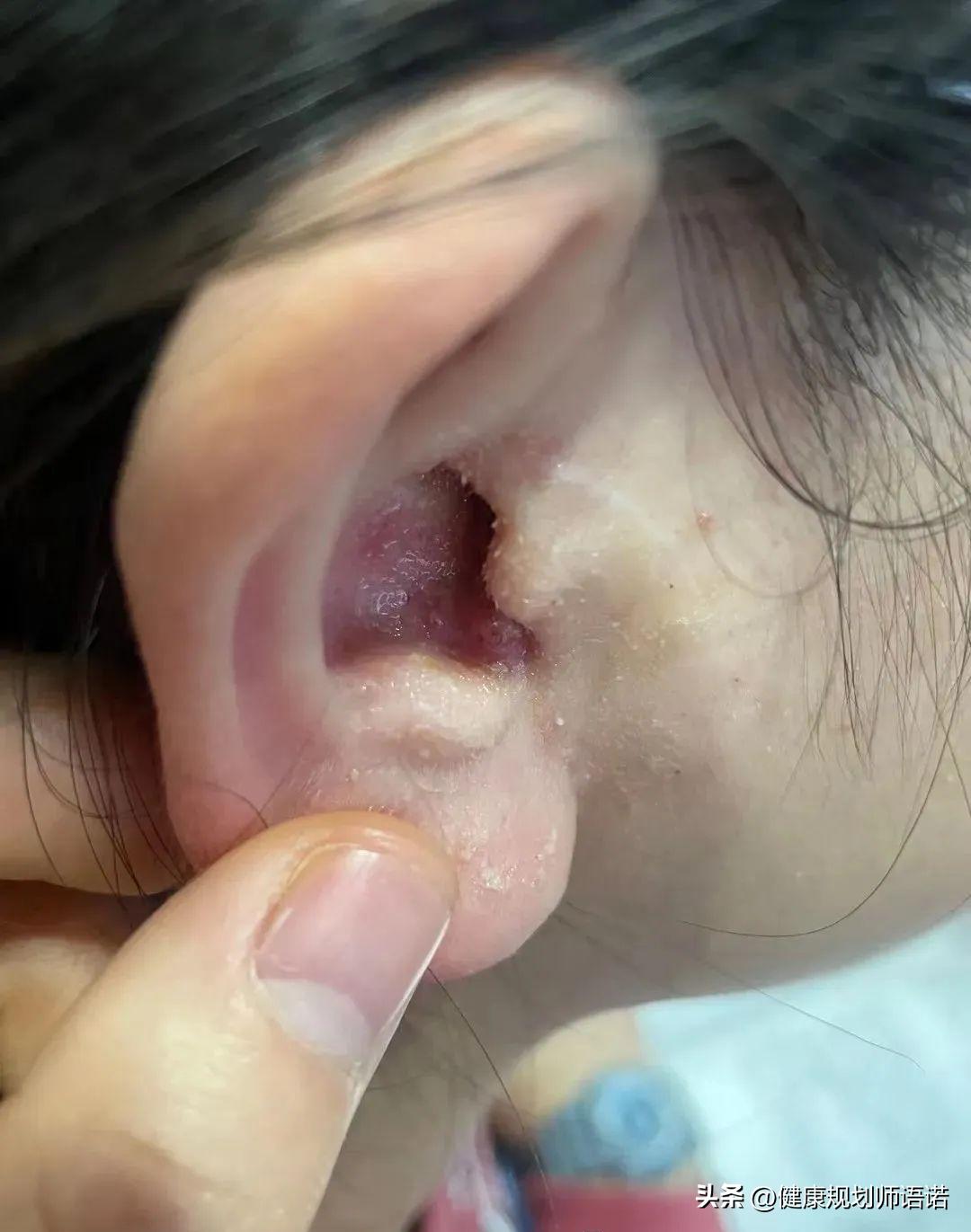 因宫颈问题走进阳光森林，用营养拯救了整个家族的健康