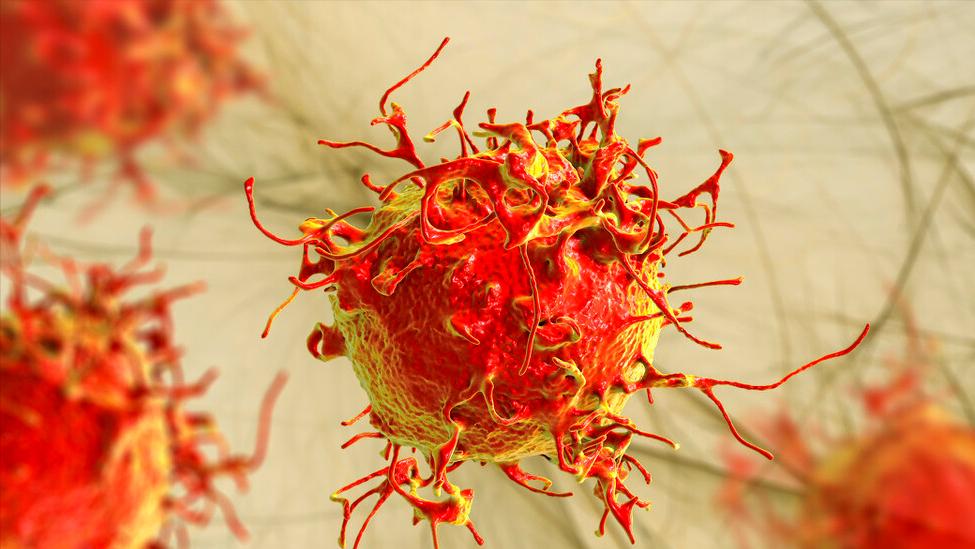 吃生大蒜抗癌真实性如何,生吃大蒜可以抗肿瘤吗