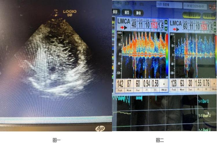 一打喷嚏就头疼是什么类型的感冒,一打喷嚏就感冒是什么原因