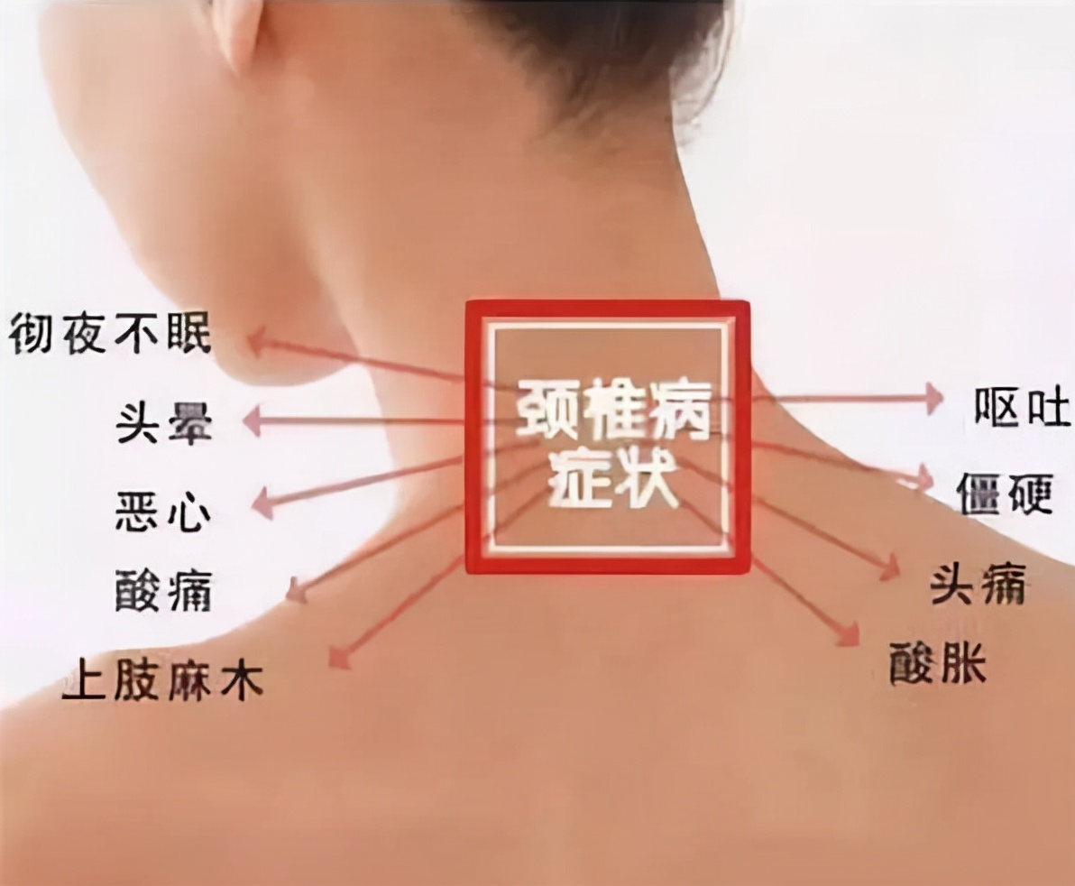 颈椎病导致的手麻和胳膊疼怎么治,手麻怎么分辨是脑血栓还是颈椎病