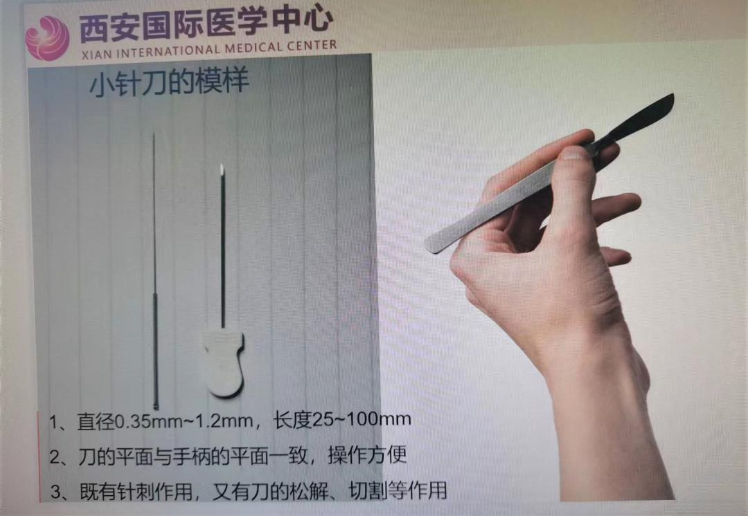 镇痛界的“小李飞刀”，你听说过吗？