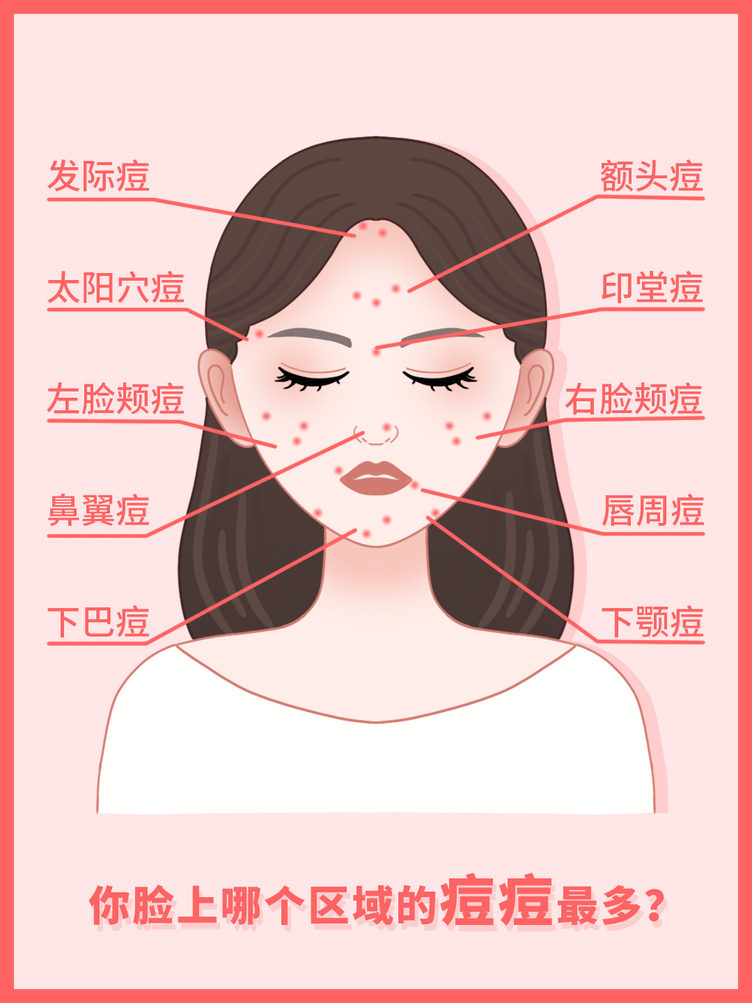 脸颊总是长痘的原因和治疗方法,脸部各部分长痘原因及解决方案