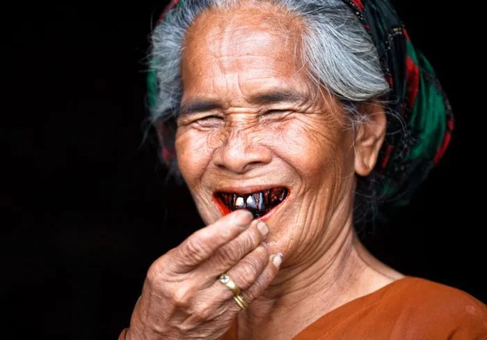 槟榔是诱发口腔癌的罪魁祸首,槟榔的危害口腔癌患者最初症状