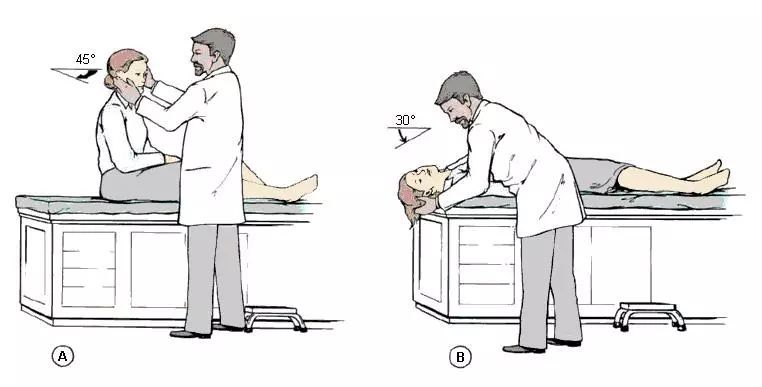 耳石症crp治疗,耳石症bppv