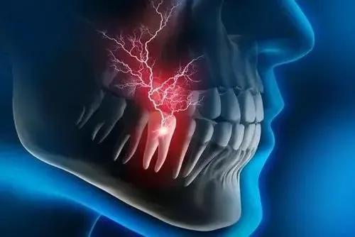 60岁老人老是间歇性牙疼,56岁男老牙疼是咋回事
