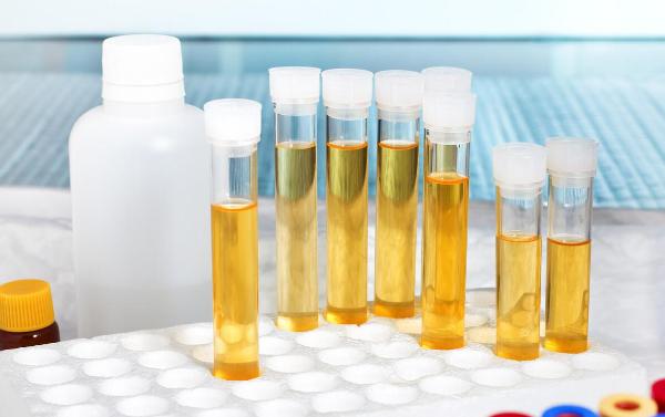 宫颈癌的表现会拉尿困难吗,宫颈癌有4个征兆会来月经