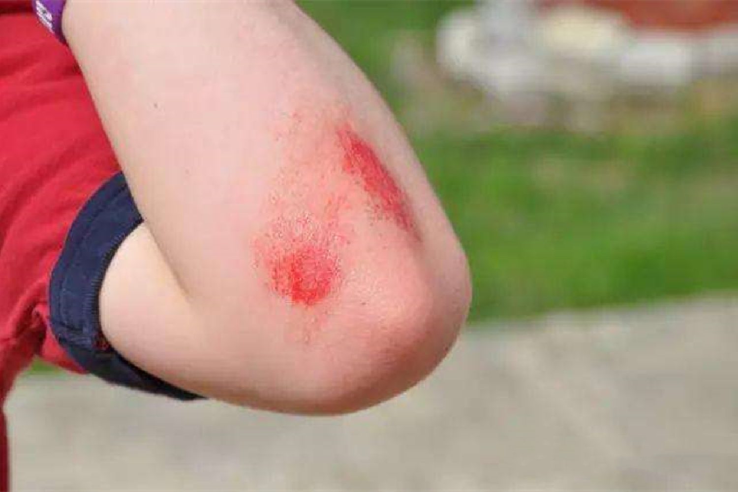 孩子滑雪斜坡摔倒了有危险吗,六岁女孩滑雪需要准备什么