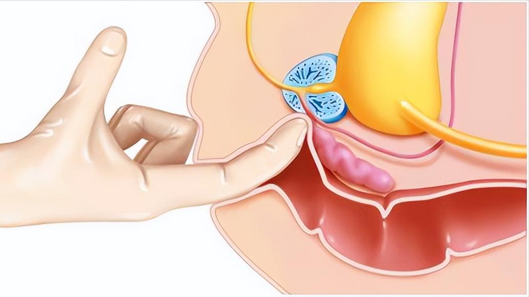 网上说前列腺治愈的都是骗人的吗,网上广告治疗前列腺可信吗