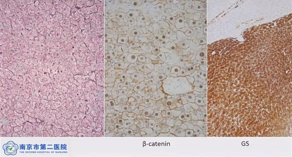 肝囊肿和肝占位影像学鉴别,杨永峰医生个人简历