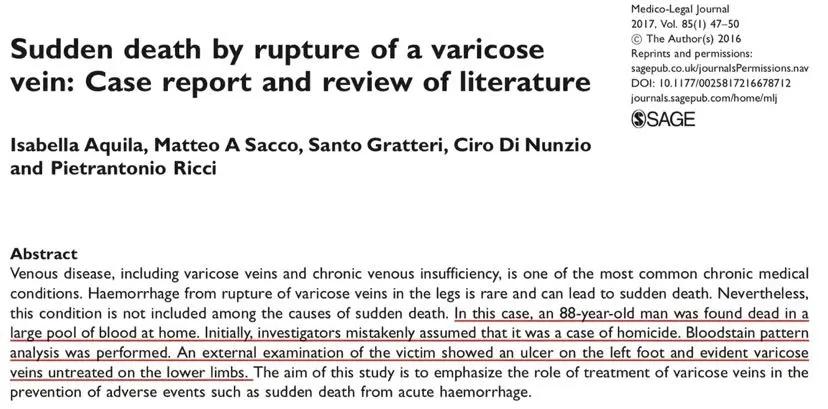 静脉曲张导致肺栓塞的案例,静脉曲张导致的血栓案例